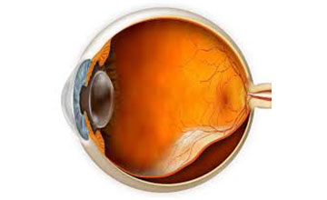 Retina Treatment